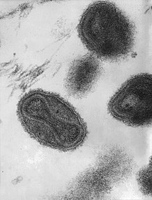 This transmission electron micrograph depicts a number of smallpox virions. The "dumbbell-shaped" structure inside the virion is the viral core, which contains the viral DNA; Mag. = ~370,000×