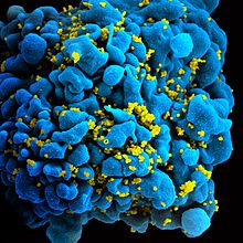 صورة لأحد الخلايا الليمفاوية المصابة بفيروس الأيدز